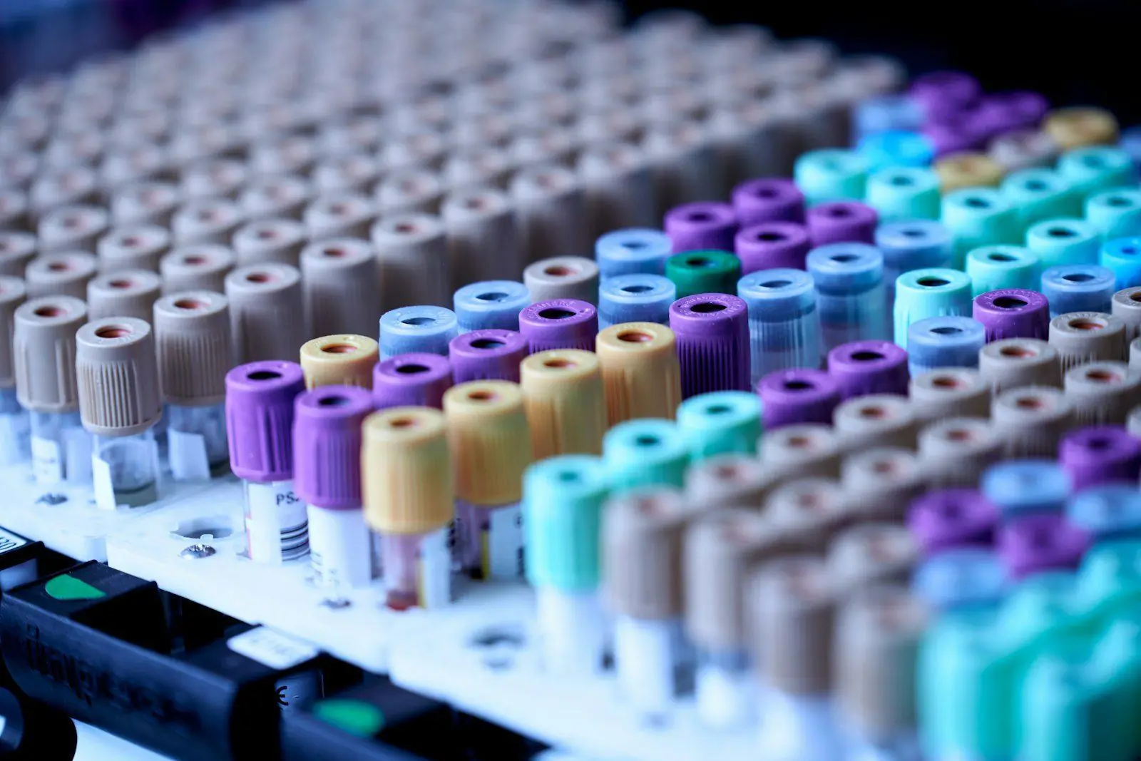 Sample vials racked in a clinical lab